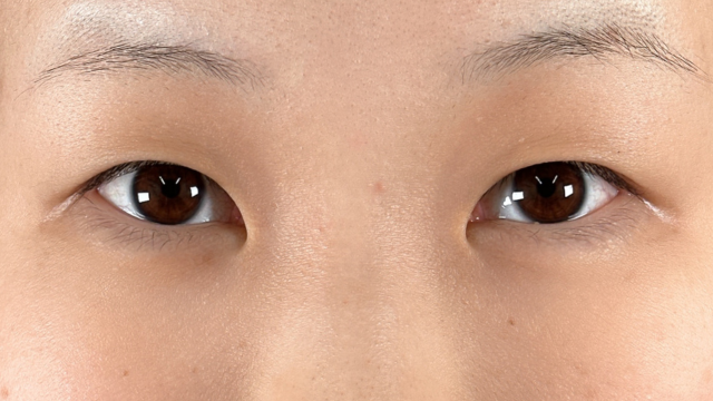 手术前的状态 其一