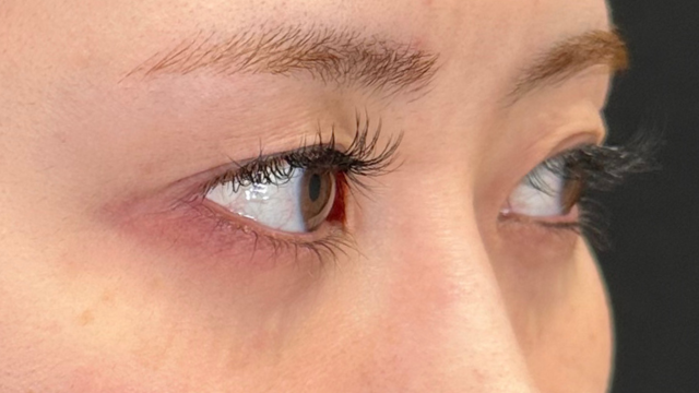 手术前的状态 其一