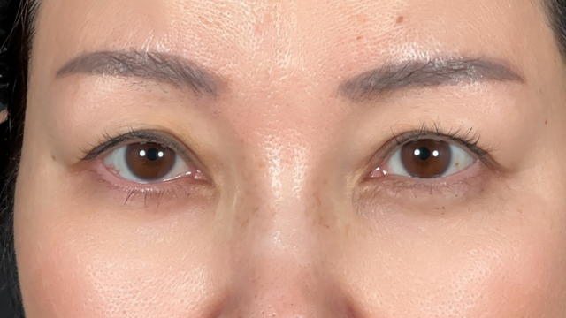 Preoperative Condition Part 1