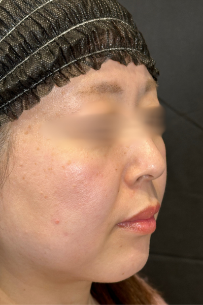 Preoperative Condition Part 1