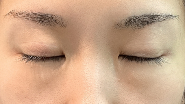 手术前的状态 其一