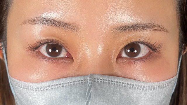 手术前的状态 其一