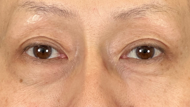 Preoperative Condition Part 1