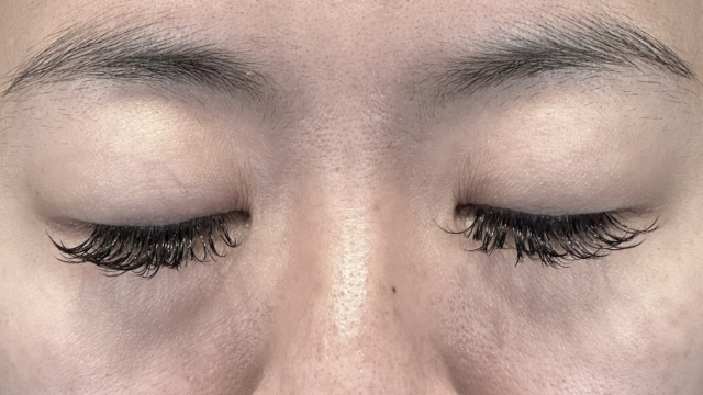 Preoperative Condition Part 1