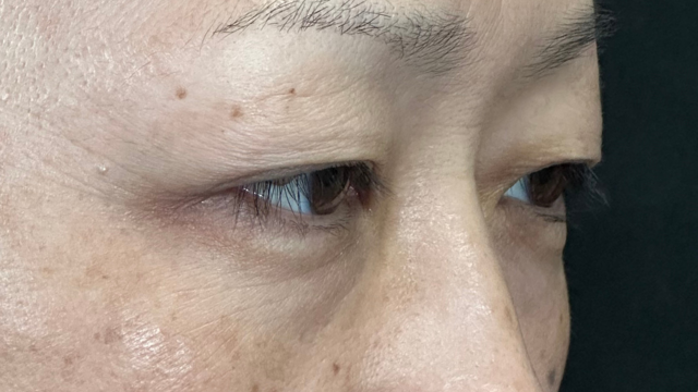 Preoperative Condition Part 1