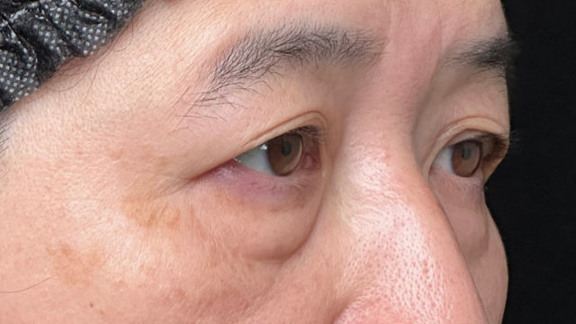 Preoperative Condition Part 1