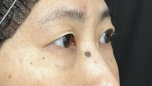 Preoperative Condition Part 1