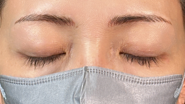 Preoperative Condition Part 1