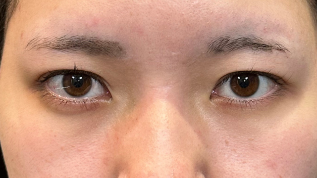 手术前的状态 其一