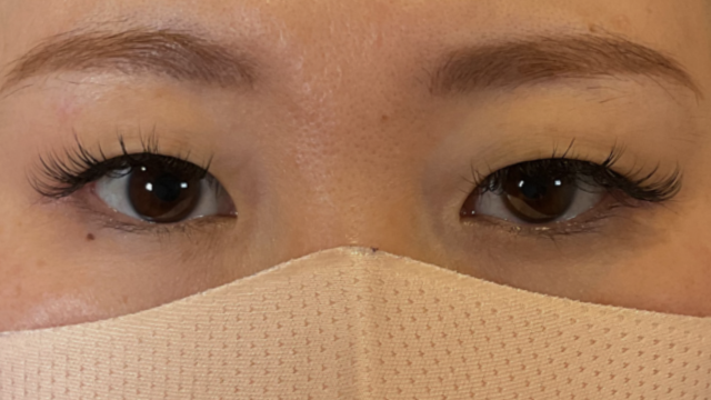 手术前的状态 其一