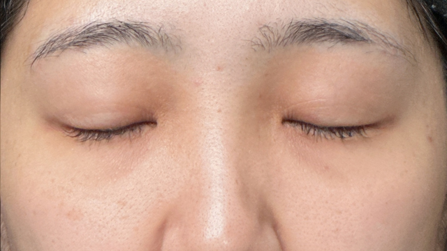 手术前的状态 其一