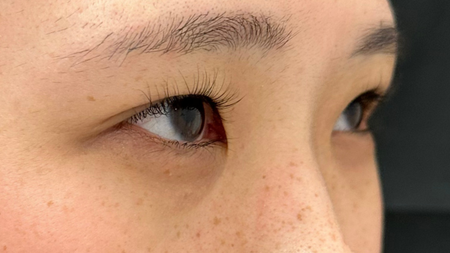 手术前的状态 其一