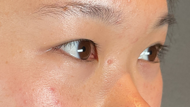 手术前的状态 其一