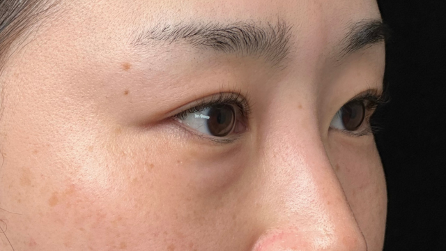 手术前的状态 其一