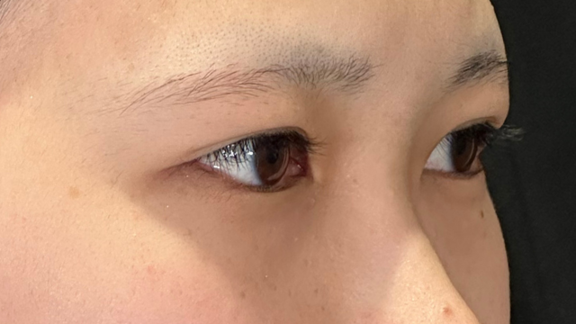 手术前的状态 其一