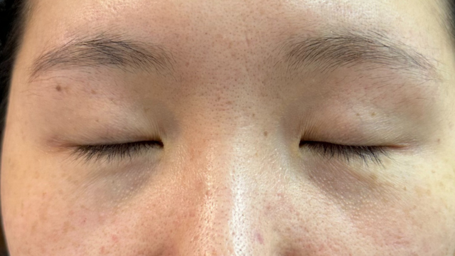 Preoperative Condition Part 1