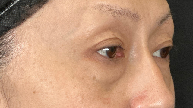 Preoperative Condition Part 1