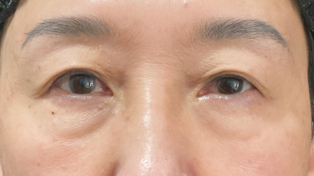 手术前的状态 其一