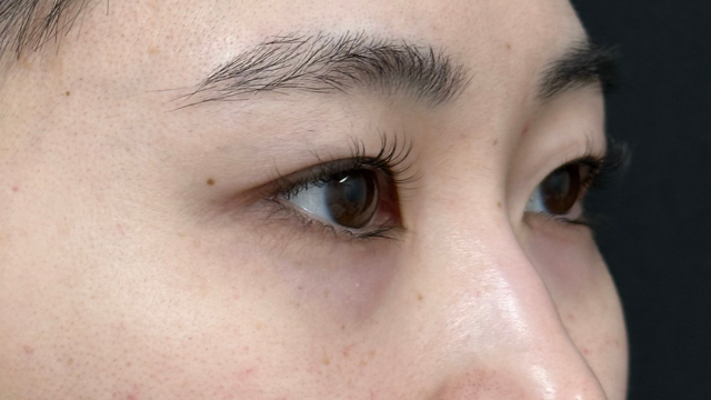 手术前的状态 其一