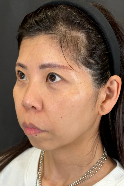 Preoperative Condition Part 1