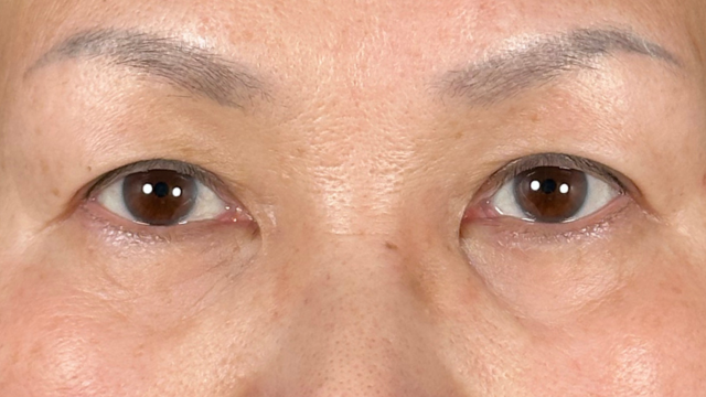 Preoperative Condition Part 1