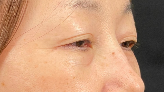 手术前的状态 其一