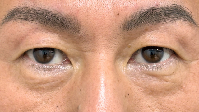 Preoperative Condition Part 1