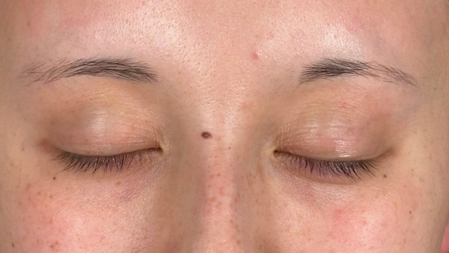 手术前的状态 其一