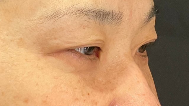 手术前的状态 其一