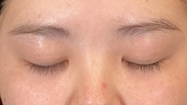 手术前的状态 其一