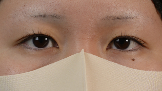 手术前的状态 其一