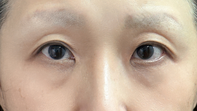 Preoperative Condition Part 1