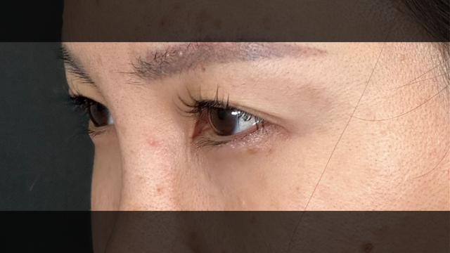 Preoperative Condition Part 1