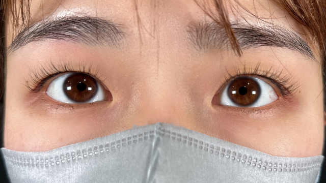 手术前的状态 其一