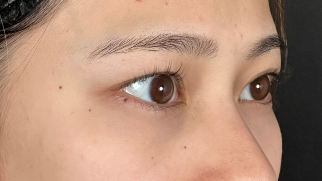 手术前的状态 其一