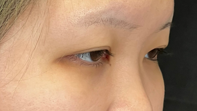 手术前的状态 其一