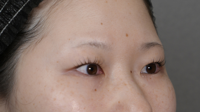 手术前的状态 其一