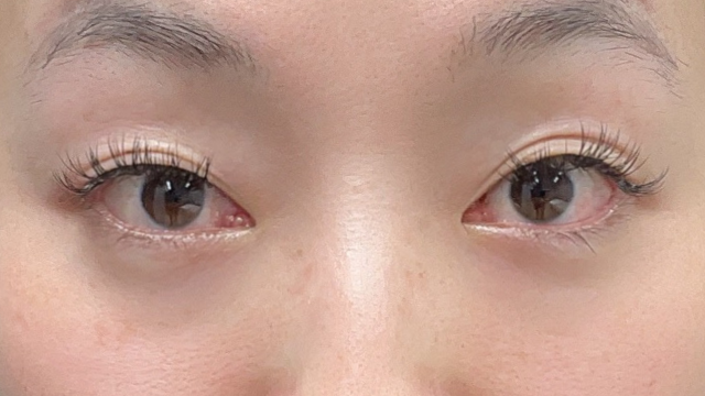 手术前的状态 其一