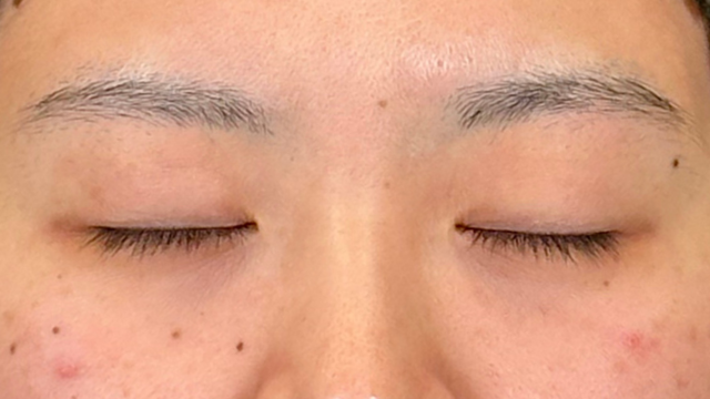 Preoperative Condition Part 1