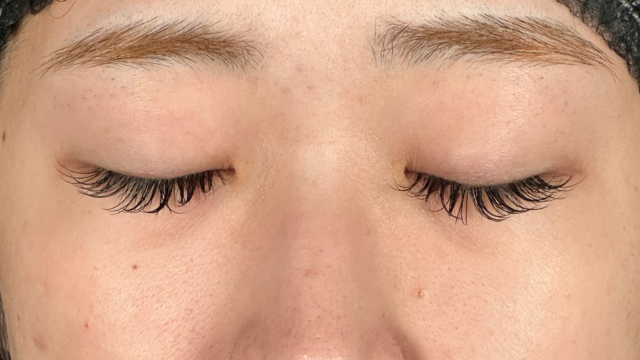 手术前的状态 其一