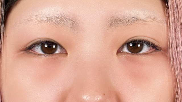 手术前的状态 其一