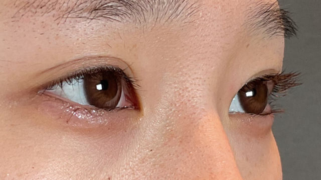 手术前的状态 其一