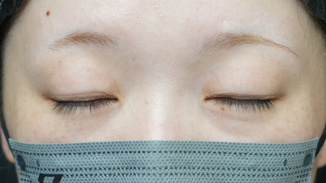 手术前的状态 其一