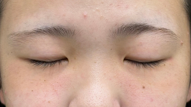 Preoperative Condition Part 1