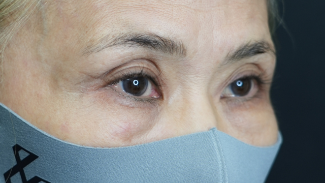 手术前的状态 其一