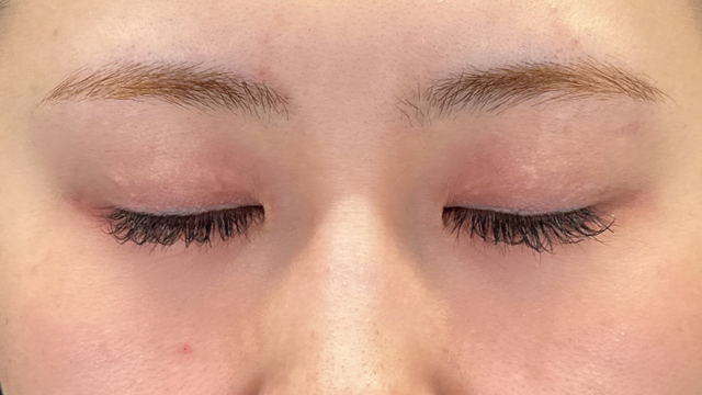 手术前的状态 其一