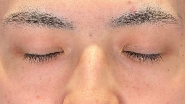 Preoperative Condition Part 1