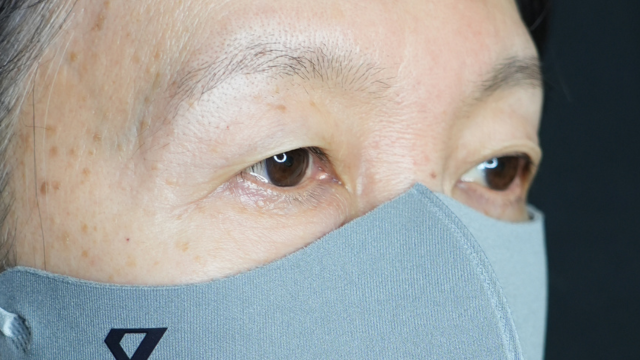 手术前的状态 其一