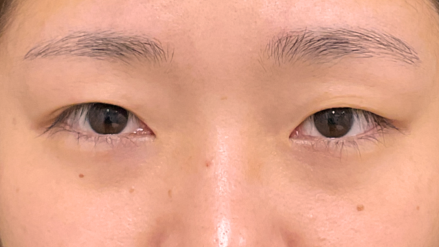 手术前的状态 其一