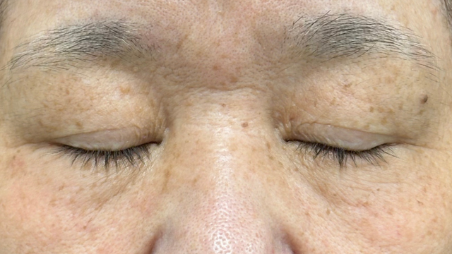 手术前的状态 其一